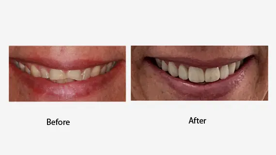 Complete Dental Care