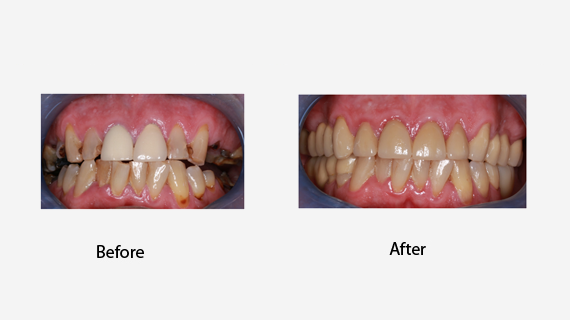Complete Dental Care